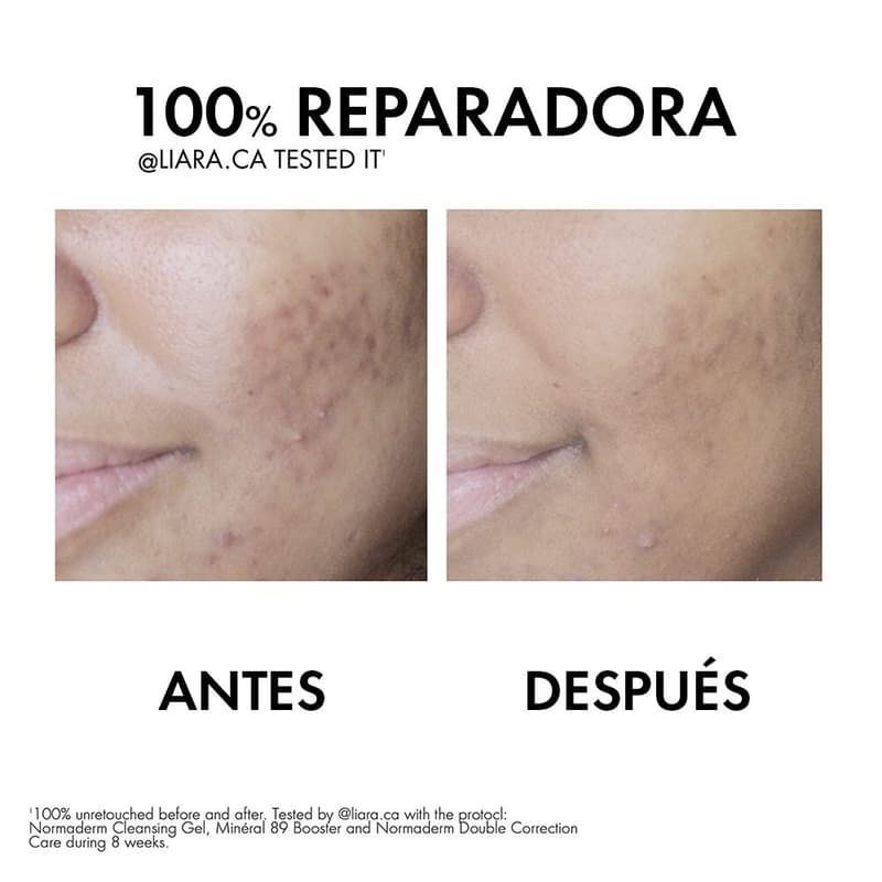 Vichy Normaderm Phytosolution 50ml Gel Facial - Imagen 5